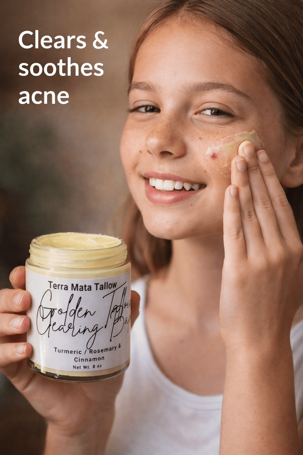 Natural Eczema Relief: Why Tallow Balm Works When Creams Fail
