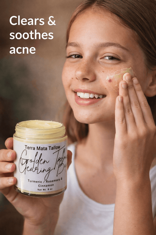 Natural Eczema Relief: Why Tallow Balm Works When Creams Fail