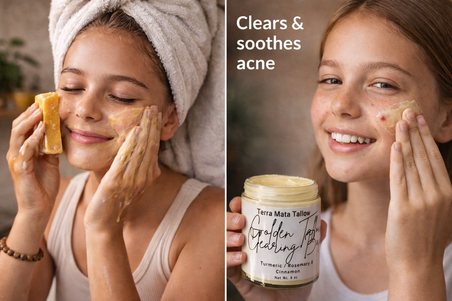 Golden tallow turmeric clearing balm and turmeric clearing soap bundle